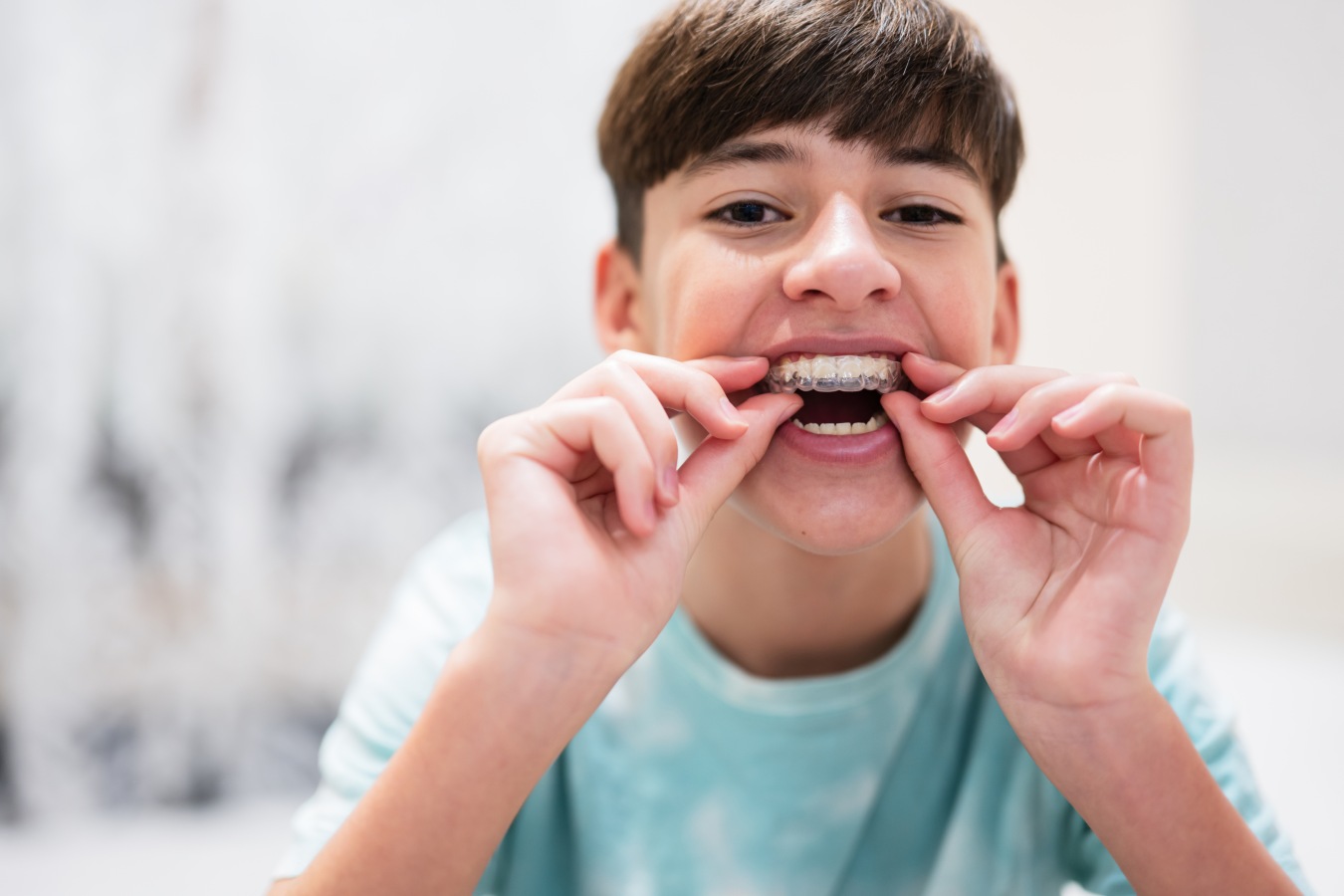 Boy placing a clear Invisalign aligner over his teeth